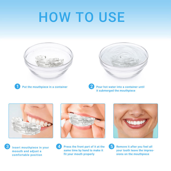 Premium Anti-Snoring Mouth Guard for Teeth Grinding & Sleep Apnea Relief – Comfortable, Reusable Sleep Aid with Storage Box