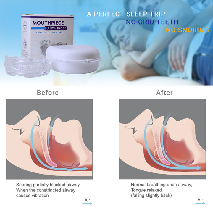 Premium Anti-Snoring Mouth Guard for Teeth Grinding & Sleep Apnea Relief – Comfortable, Reusable Sleep Aid with Storage Box