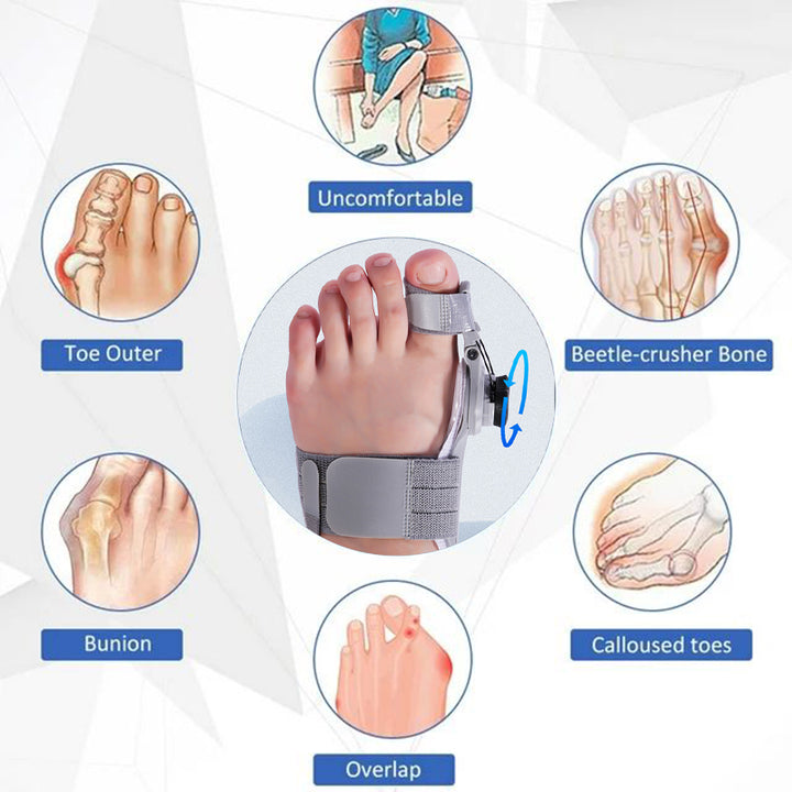 High-Quality Bunion Corrector Unisex Toe Separator for Hallux Valgus – Adjustable, Rotatable Toe Straightener, Foot Care 